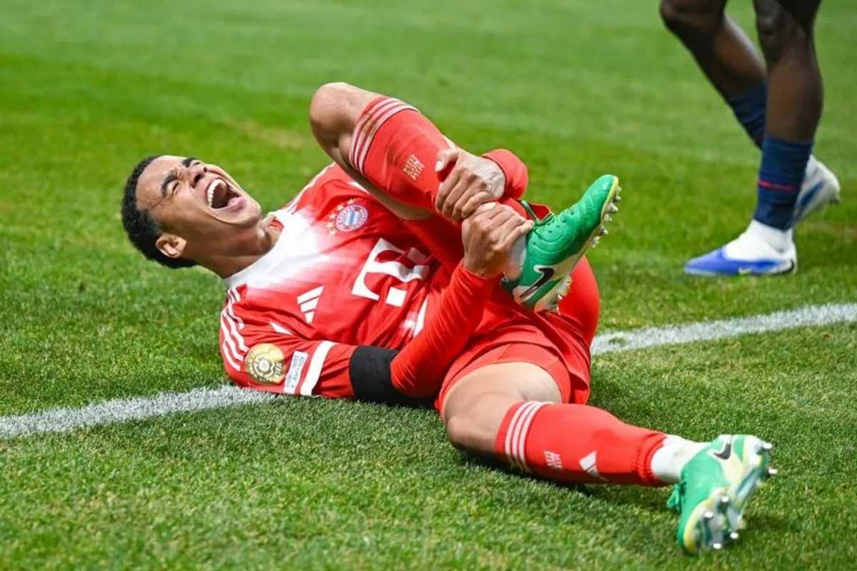 Musiala Cedera Parah dan Gugur dari PSG